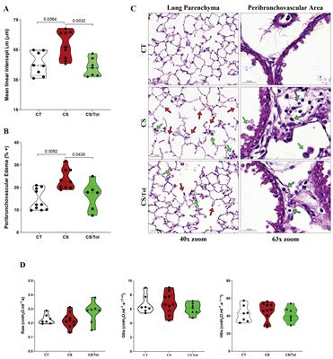 Type V collagen-induced nasal tolerance prevents lung damage in an experimental model: new evidence of autoimmunity to collagen V in COPD